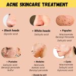 Panduan Lengkap Acnes Spot Care: Cara Kerja, Kandungan, dan Tips Menghilangkan Jerawat Membandel